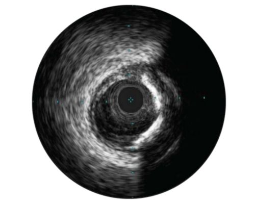 Assessment of lesions