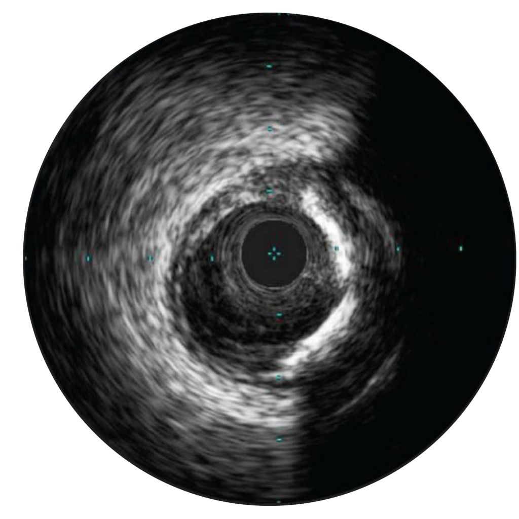Assessment of lesions