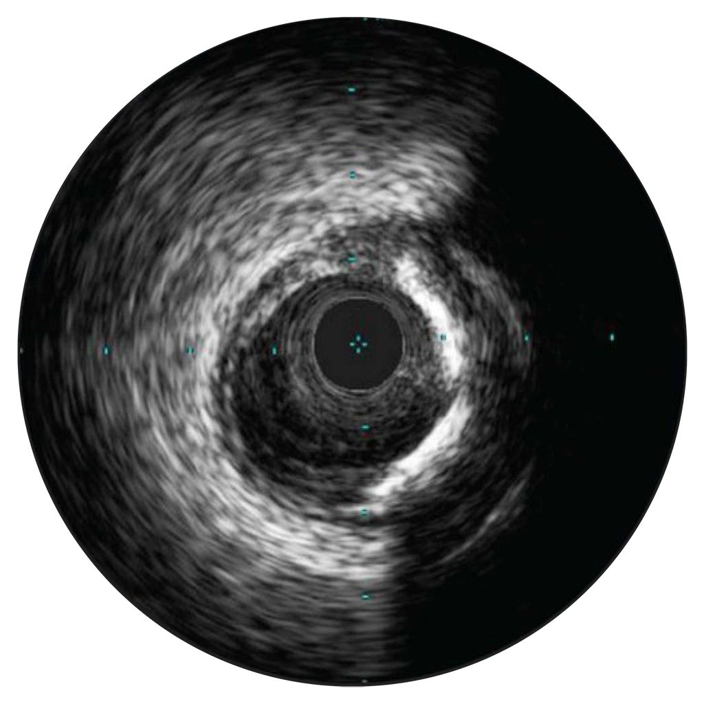 Assessment of lesions