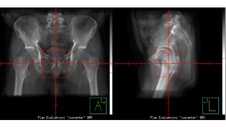 MRI as primary image set in treatment planning