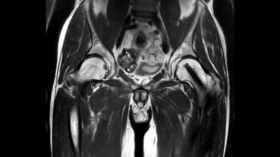 IMPLANTED MIND　エイハブ IMPLANTED MIND - Album by エイハブ