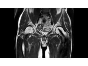 SmartSpeed Implant MR Clinical Applications