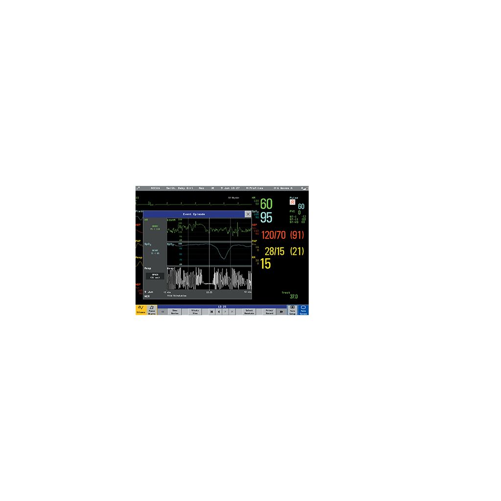 Effective respiratory monitoring