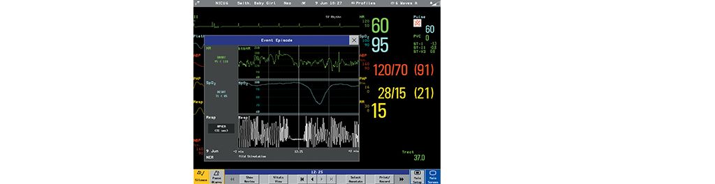 Effective respiratory monitoring