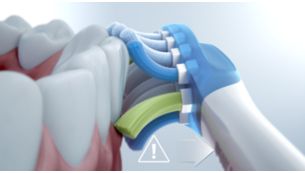 Upozorní vás, ak pri čistení príliš zatlačíte na zuby