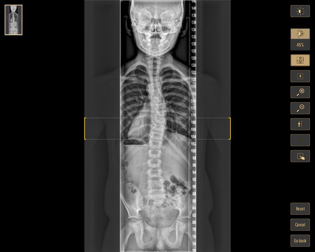 Personalized control