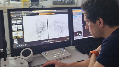 Clinician reviewing neurovascular imaging on Philips Azurion system monitors