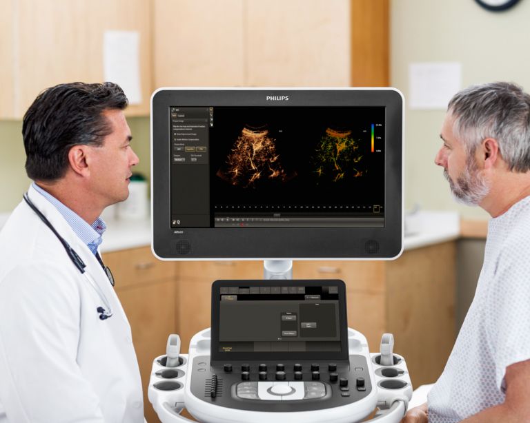 Philips Affiniti ultrasound machines