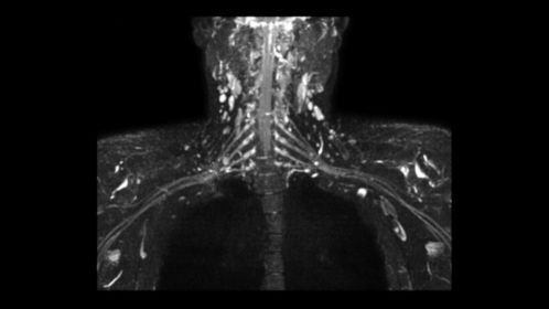3D NerveView