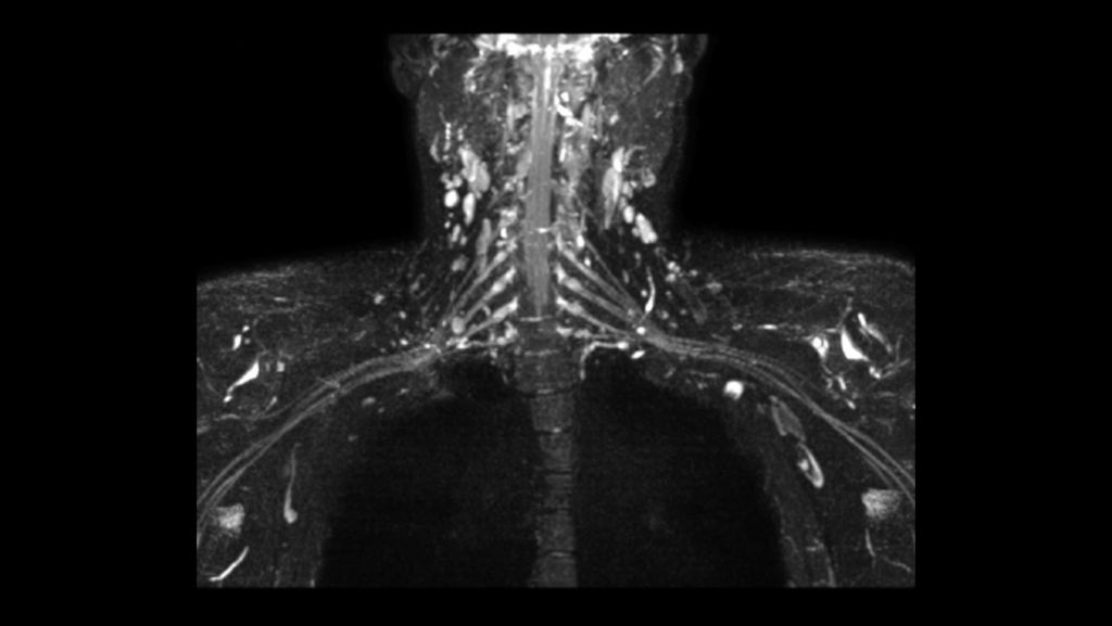 3D NerveView