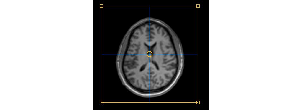 SmartExam Brain - Auto alignment of the imaging slices