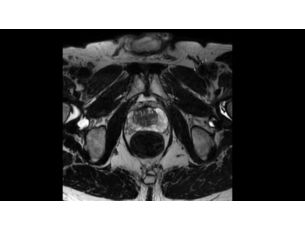 3D PelvisVIEW MR clinical application