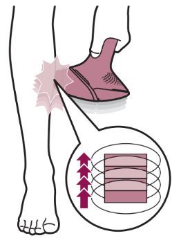 The correct pattern of flashes with Philips Lumea